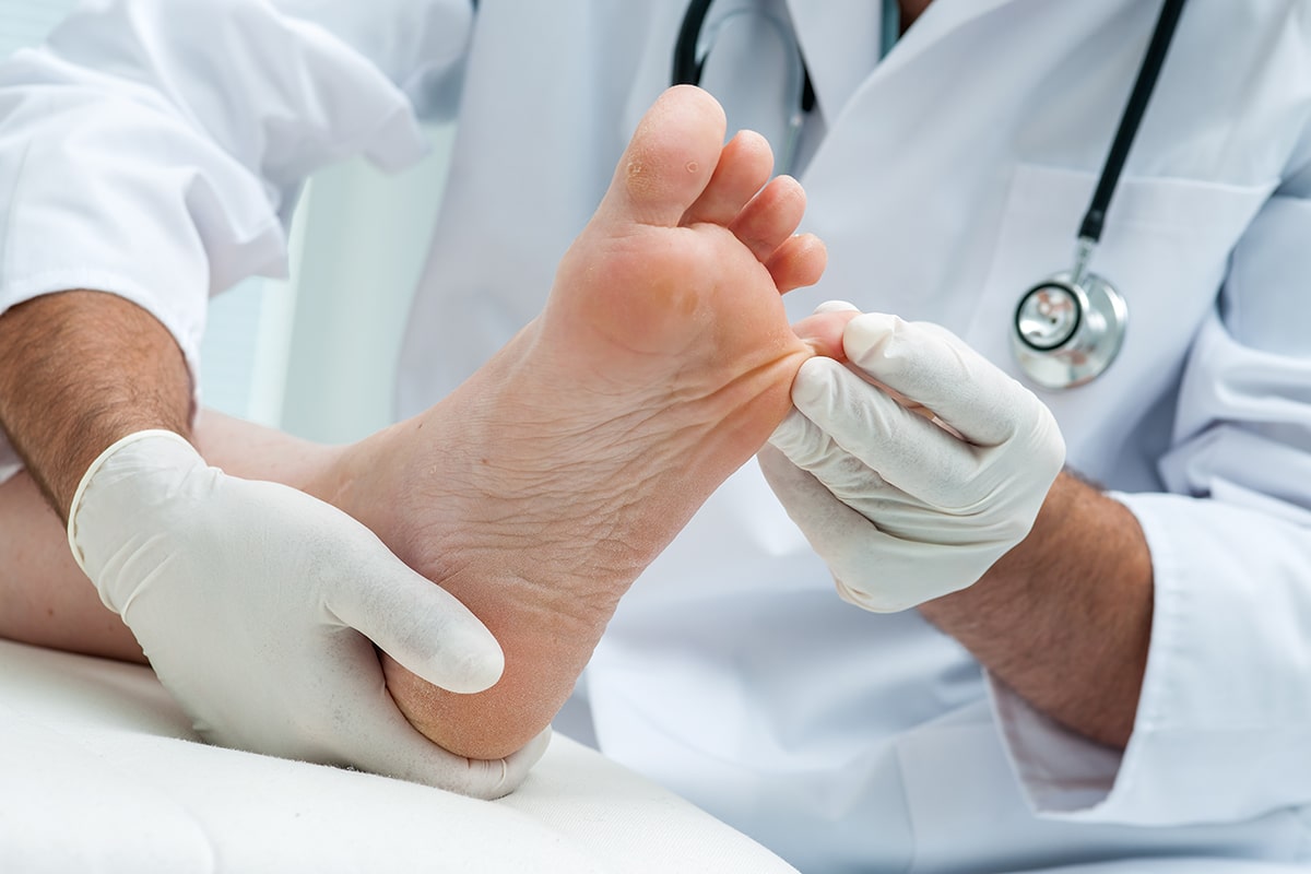 doctor examining athlete's foot between toes